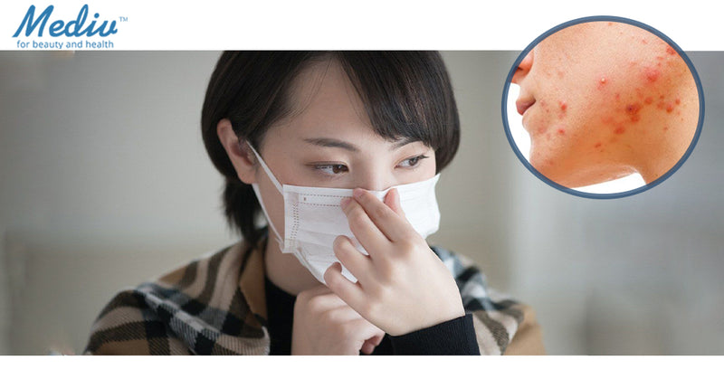 【口罩肌/口罩暗瘡拜拜】10個長期戴口罩的護膚心得及口罩肌護膚品推介