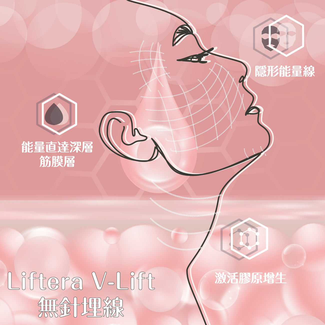 LifteraV 輪廓提升緊緻皇牌療程